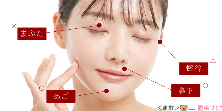 顔脱毛で脱毛できる箇所・できない箇所