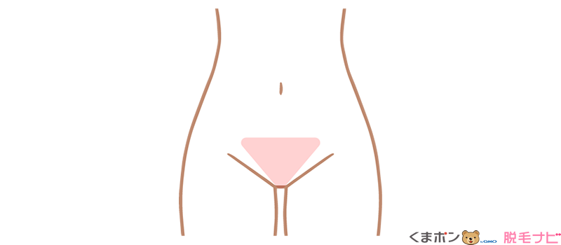 Vライン脱毛の痛みの感じ方
