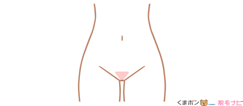 トライアングルミニ